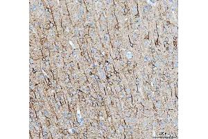 IHC analysis of Alpha Internexin using anti-Alpha Internexin antibody (ABIN4886634).