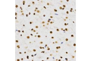 Immunohistochemistry of paraffin-embedded rat brain using DiMethyl-Histone H3-K9 antibody (ABIN1872998) at dilution of 1:200 (40x lens).