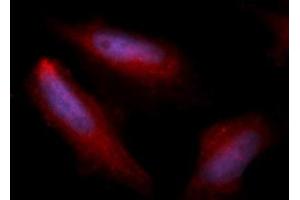 Immunofluorescence (IF) image for anti-Heparin-Binding EGF-Like Growth Factor (HBEGF) (AA 63-148) antibody (APC) (ABIN5567174) (HBEGF 抗体  (AA 63-148) (APC))