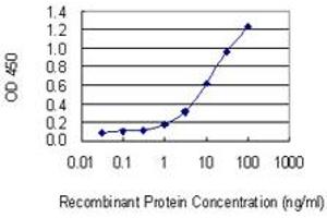 Detection limit for recombinant GST tagged SLC22A4 is 0. (SLC22A4 抗体  (AA 43-141))