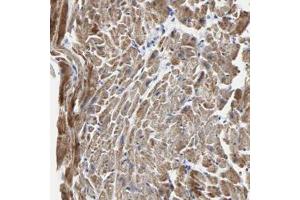 Immunohistochemical staining of human heart with NCAPH polyclonal antibody  shows strong cytoplasmic positivity in myocytes at 1:50-1:200 dilution. (NCAPH 抗体)