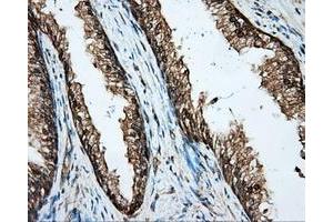 Immunohistochemical staining of paraffin-embedded Kidney tissue using anti-BSG mouse monoclonal antibody. (CD147 抗体)