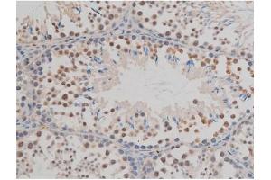 ABIN6267377 at 1/200 staining Mouse testis tissue sections by IHC-P. (GFAP 抗体  (pSer38))