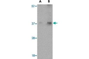 Western blot analysis of EMD in human skeletal muscle tissue lysate with EMD polyclonal antibody  at (A) 0. (Emerin 抗体  (N-Term))