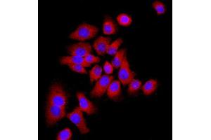 MCF-7 cells were stained with P21 Polyclonal Antibody, Unconjugated at 1:500 in PBS and incubated for two hours at 37°C followed by Goat Anti-Rabbit IgG (H+L) Cy3 conjugated secondary antibody. (p21 抗体  (AA 21-100))