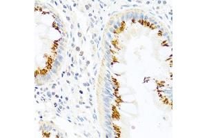 Immunohistochemistry of paraffin-embedded human colon using FB antibody (ABIN3021390, ABIN3021391, ABIN3021392 and ABIN6215001) at dilution of 1:100 (40x lens). (FAM3B 抗体  (AA 30-235))