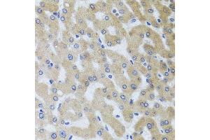 Immunohistochemistry of paraffin-embedded human liver injury using UVRAG antibody. (UVRAG 抗体  (AA 501-699))