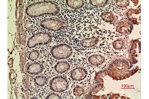 Immunohistochemistry (IHC) analysis of paraffin-embedded Human Colon, antibody was diluted at 1:100. (LIF 抗体  (C-Term))