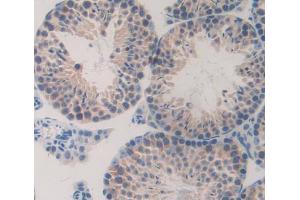 Used in DAB staining on fromalin fixed paraffin- embedded testis tissue (TESK1 抗体  (AA 52-309))
