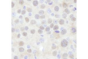 Immunohistochemistry (IHC) image for anti-Chromodomain Helicase DNA Binding Protein 3 (CHD3) (AA 1950-2000) antibody (ABIN7448475) (CHD3 抗体  (AA 1950-2000))