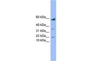 Image no. 1 for anti-LYR Motif Containing 1 (LYRM1) (AA 35-84) antibody (ABIN6744194) (LYRM1 抗体  (AA 35-84))