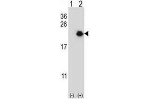 Western blot analysis of EIF4EBP1 (arrow) using rabbit polyclonal EIF4EBP1 Antibody (Center) . (eIF4EBP1 抗体  (Middle Region))