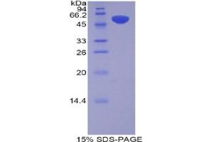 SDS-PAGE analysis of Rat Pregnancy Zone Protein. (PZP 蛋白)
