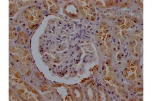 IHC image of ABIN7175288 diluted at 1:200 and staining in paraffin-embedded human kidney tissue performed on a Leica BondTM system. (VPS26A 抗体  (AA 21-180))