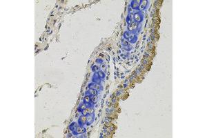 Immunohistochemistry of paraffin-embedded mouse lung using GAS6 antibody at dilution of 1:100 (x40 lens).