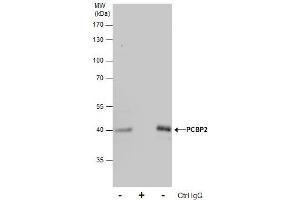 Immunoprecipitation (IP) image for anti-Poly(rC) Binding Protein 2 (PCBP2) antibody (ABIN2856965)