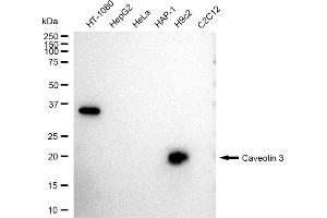 Western blotting analysis using Caveolin 3 antibody (ABIN7797947).