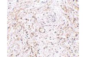 Immunohistochemistry of TEM5 in human bladder tissue with this product at 5 μg/ml. (GPR124 抗体  (Center))