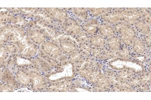 Detection of SHH in Human Kidney Tissue using Monoclonal Antibody to Hedgehog Homolog, Sonic (SHH) (Sonic Hedgehog 抗体  (AA 36-193))