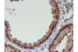 Immunohistochemical staining of paraffin-embedded Human breast tissue using anti-PSMD2 mouse monoclonal antibody. (PSMD2 抗体)