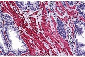 Human Prostate: Formalin-Fixed, Paraffin-Embedded (FFPE) (SMURF1 抗体  (AA 165-269))