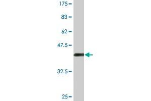 Western Blot detection against Immunogen (36. (HIPK4 抗体  (AA 519-616))