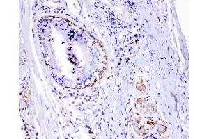 IHC analysis of TL1A using anti-TL1A antibody (ABIN5693289).
