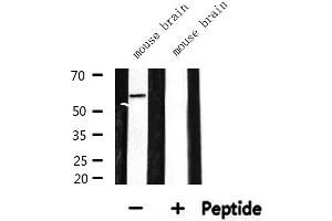 Western Blotting (WB) image for anti-CDK5 Regulatory Subunit Associated Protein 1-Like 1 (CDKAL1) (N-Term) antibody (ABIN6259603)