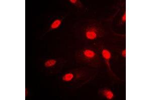 Immunofluorescent analysis of AP2 alpha/beta staining in HepG2 cells. (AP2 alpha/beta (C-Term) 抗体)