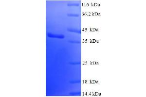 SUMO/sentrin Specific Peptidase Family Member 8 (SENP8) (AA 1-212), (full length) protein (His-SUMO Tag)