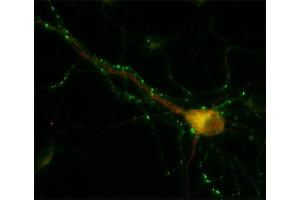 Immunocytochemistry (ICC) image for anti-Early Endosome Antigen 1 (EEA1) (AA 2-13) antibody (ABIN1742484) (EEA1 抗体  (AA 2-13))