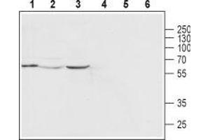 Western blot analysis of human MCF-7 breast adenocarcinoma cell line (lanes 1 and 4), rat heart (lanes 2 and 5) and mouse heart (lanes 3 and 6) lysates: - 1-3. (Mucolipin 2 (MCOLN2) (AA 212-228), (Intracellular), (N-Term) 抗体)