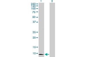 Western Blot analysis of CXCL6 expression in transfected 293T cell line by CXCL6 MaxPab polyclonal antibody. (CXCL6 抗体  (AA 1-114))