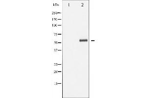Western blot analysis of p62 Dok phosphorylation expression in Jurkat whole cell lysates,The lane on the left is treated with the antigen-specific peptide.
