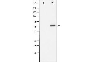Western blot analysis of p62 Dok phosphorylation expression in Jurkat whole cell lysates,The lane on the left is treated with the antigen-specific peptide. (DOK1 抗体  (pTyr362))