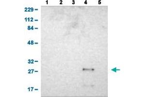 Western Blot analysis of (1) human cell line RT-4 (2) human cell line U-251MG sp (3) human plasma (IgG/HSA depleted) (4) human liver tissue, and (5) human tonsil tissue. (ASB6 抗体  (AA 10-133))