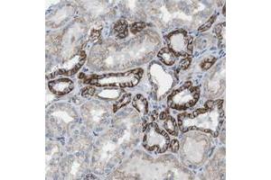 Immunohistochemical staining of human kidney with CLMN polyclonal antibody  shows strong membranous positivity in cells in tubules. (CLMN 抗体)
