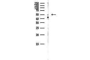 anti-Internexin Neuronal Intermediate Filament Protein, alpha (INA) (Internal Region) antibody