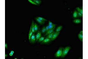 Immunofluorescent analysis of HepG2 cells using ABIN7173463 at dilution of 1:100 and Alexa Fluor 488-congugated AffiniPure Goat Anti-Rabbit IgG(H+L) (TRIM54 抗体  (AA 60-358))