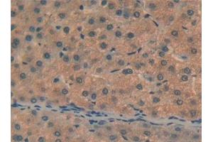 Immunohistochemistry (IHC) image for anti-Complement Component 6 (C6) (AA 682-934) antibody (ABIN7435277)