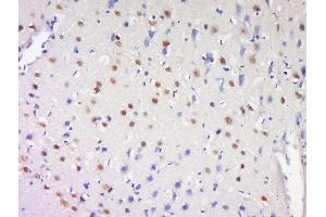Formalin-fixed and paraffin embedded rat brain labeled with Anti-ProSAPiP1 Polyclonal Antibody, Unconjugated  at 1:200 followed by conjugation to the secondary antibody and DAB staining (ProSAPiP1 抗体  (AA 151-250))