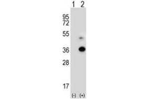 Western blot analysis of ANGPTL7 antibody and 293 cell lysate either nontransfected (Lane 1) or transiently transfected (2) with the ANGPTL7 gene.
