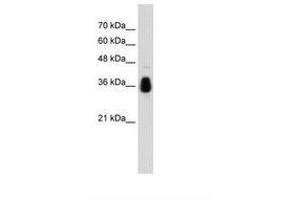 Image no. 1 for anti-Makorin Ring Finger Protein 1 (MKRN1) (AA 371-420) antibody (ABIN203525) (MKRN1 抗体  (AA 371-420))