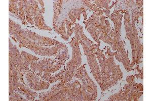 Immunohistochemistry (IHC) image for anti-Enolase 1 (ENO1) (AA 2-434) antibody (ABIN7143869)