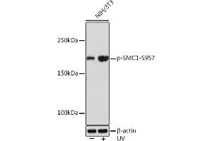 Western blot analysis of extracts of NIH/3T3 cells, using Phospho-SMC1-S957 Rabbit mAb (ABIN7270613) at 1:1000 dilution. (SMC1A 抗体  (pSer957))
