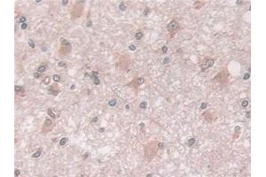 Immunohistochemistry (IHC) image for anti-Coxsackie Virus and Adenovirus Receptor (CXADR) (AA 20-229) antibody (ABIN7441556)
