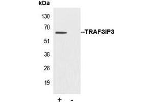Immunoprecipitation of TRAF3IP3 from 0. (TRAF3IP3 抗体  (Center))