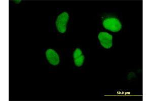 Immunofluorescence of purified MaxPab antibody to GTF3C5 on HeLa cell. (GTF3C5 抗体  (AA 1-519))
