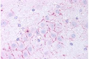 Human Dentate Gyrus (formalin-fixed, paraffin-embedded) stained with TAAR5 antibody ABIN213486 at 20 ug/ml followed by biotinylated goat anti-rabbit IgG secondary antibody ABIN481713, alkaline phosphatase-streptavidin and chromogen. (TAAR5 抗体  (N-Term))