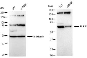 Western blotting analysis using ALAS1 antibody (ABIN7797590). (Recombinant ALAS1 抗体)